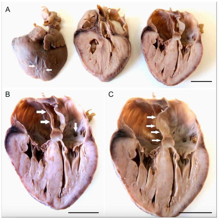 https://cdn.ncbi.nlm.nih.gov/pmc/blobs/1b9c/10532305/0db6829857f2/jcdd-10-00370-g001.jpg
