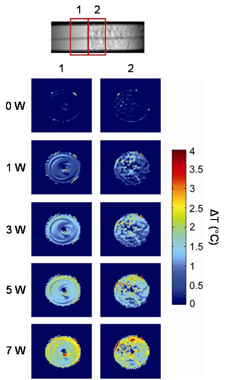 https://cdn.ncbi.nlm.nih.gov/pmc/blobs/1b9f/2806353/6329b35e7e25/1475-925X-8-42-4.jpg