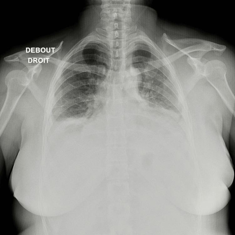 https://cdn.ncbi.nlm.nih.gov/pmc/blobs/1ba0/11723568/d6ffc96632fa/cureus-0016-00000075550-i02.jpg
