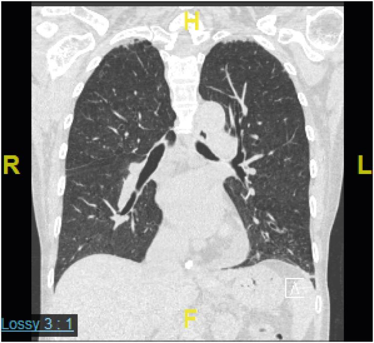 https://cdn.ncbi.nlm.nih.gov/pmc/blobs/1ba7/7610089/f4e1efe0b183/apa-10-e37-g002.jpg