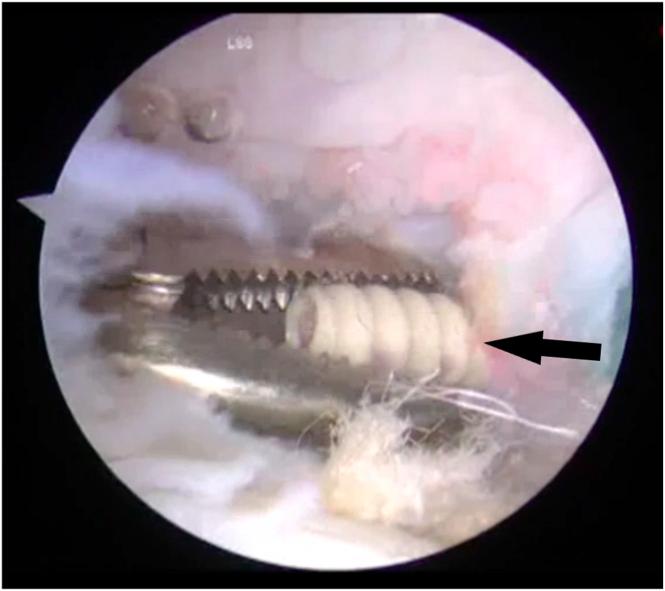 https://cdn.ncbi.nlm.nih.gov/pmc/blobs/1bac/10533940/7f3571a06cfd/gr1.jpg
