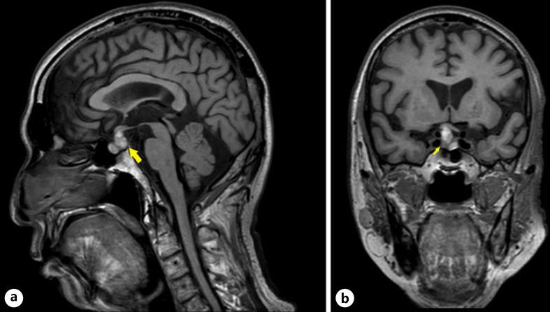 https://cdn.ncbi.nlm.nih.gov/pmc/blobs/1bac/9035960/10b79e2522ed/crn-0014-0157-g01.jpg