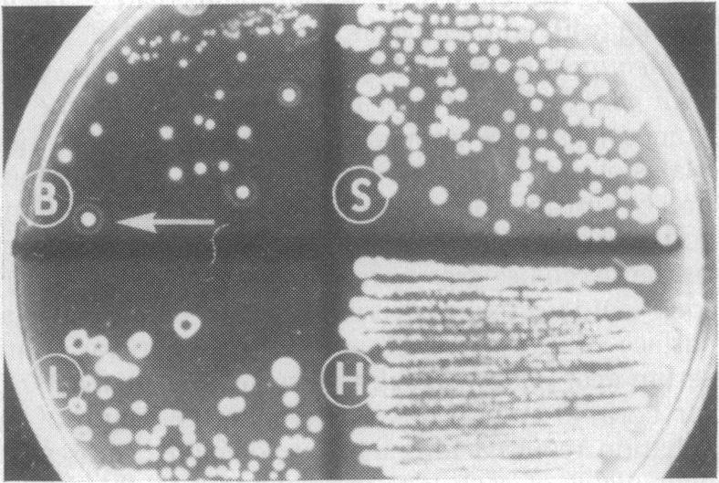 https://cdn.ncbi.nlm.nih.gov/pmc/blobs/1bb1/547603/1c226357dc0d/applmicro00244-0014-b.jpg