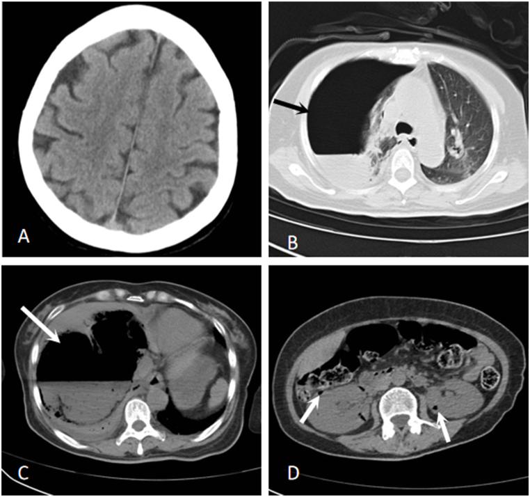 https://cdn.ncbi.nlm.nih.gov/pmc/blobs/1bb5/10877252/41b18a65839b/gr1.jpg