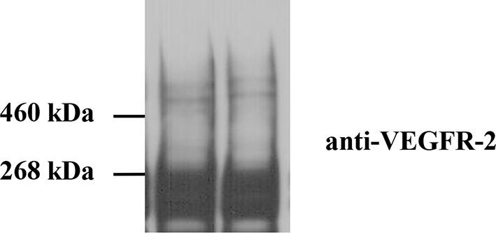 https://cdn.ncbi.nlm.nih.gov/pmc/blobs/1bb6/4829425/e61b49e7187c/elife-13876-fig2-figsupp3.jpg