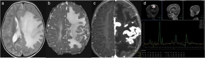 https://cdn.ncbi.nlm.nih.gov/pmc/blobs/1bb8/11896938/568b57e0f7ae/JMRI-61-1580-g001.jpg