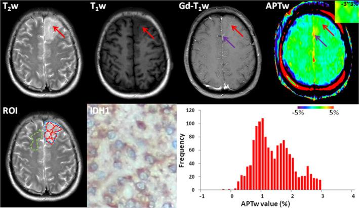 https://cdn.ncbi.nlm.nih.gov/pmc/blobs/1bb8/11896938/ae1dd41f815d/JMRI-61-1580-g008.jpg