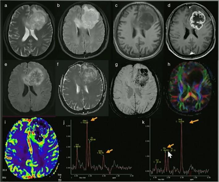 https://cdn.ncbi.nlm.nih.gov/pmc/blobs/1bb8/11896938/e7d05ff495a1/JMRI-61-1580-g010.jpg