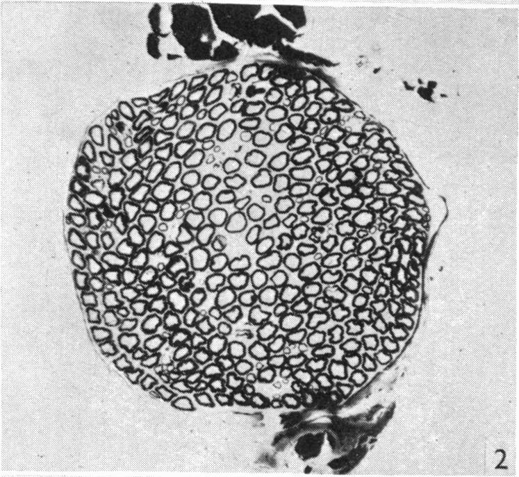 https://cdn.ncbi.nlm.nih.gov/pmc/blobs/1bbb/1273069/982d62c3e1bc/janat00489-0097-b.jpg