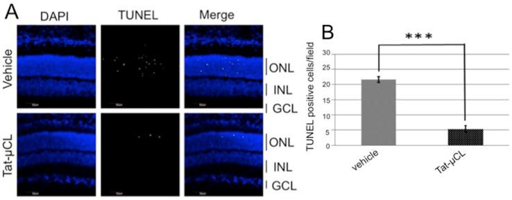 https://cdn.ncbi.nlm.nih.gov/pmc/blobs/1bc8/3739725/56d392dd2325/pone.0071650.g003.jpg