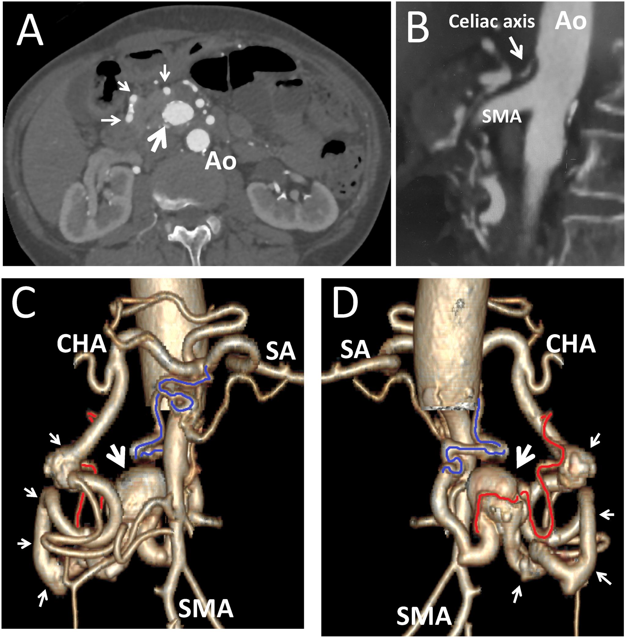 https://cdn.ncbi.nlm.nih.gov/pmc/blobs/1bc8/7751088/86e5190b3698/avd-13-3-cr.20-00011-figure02.jpg