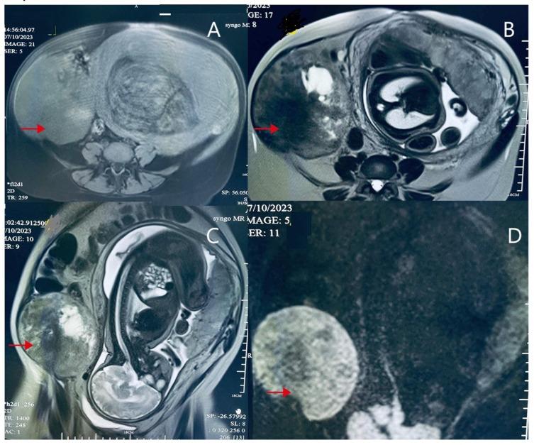 https://cdn.ncbi.nlm.nih.gov/pmc/blobs/1bcb/12292384/11284d1bfa9e/IJWH-17-2227-g0001.jpg