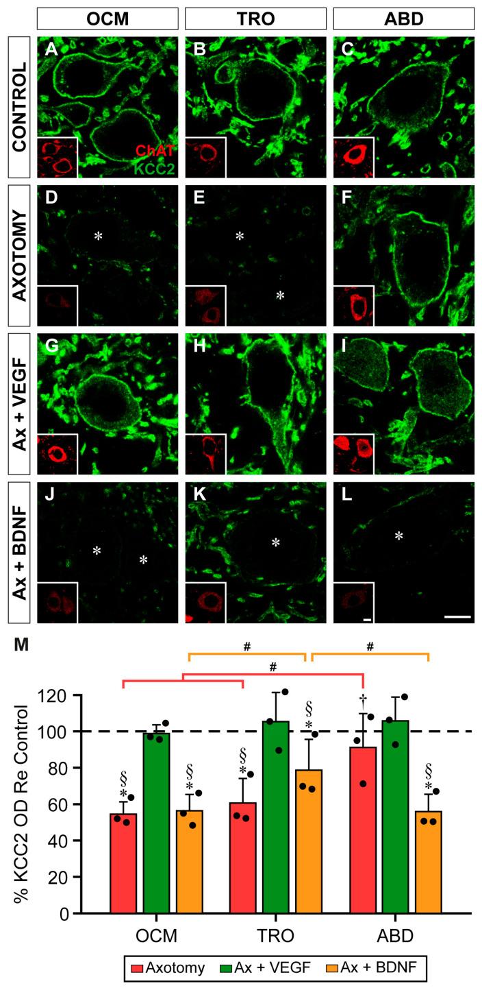 https://cdn.ncbi.nlm.nih.gov/pmc/blobs/1bcc/11432591/8e33311935d7/ijms-25-09942-g005.jpg