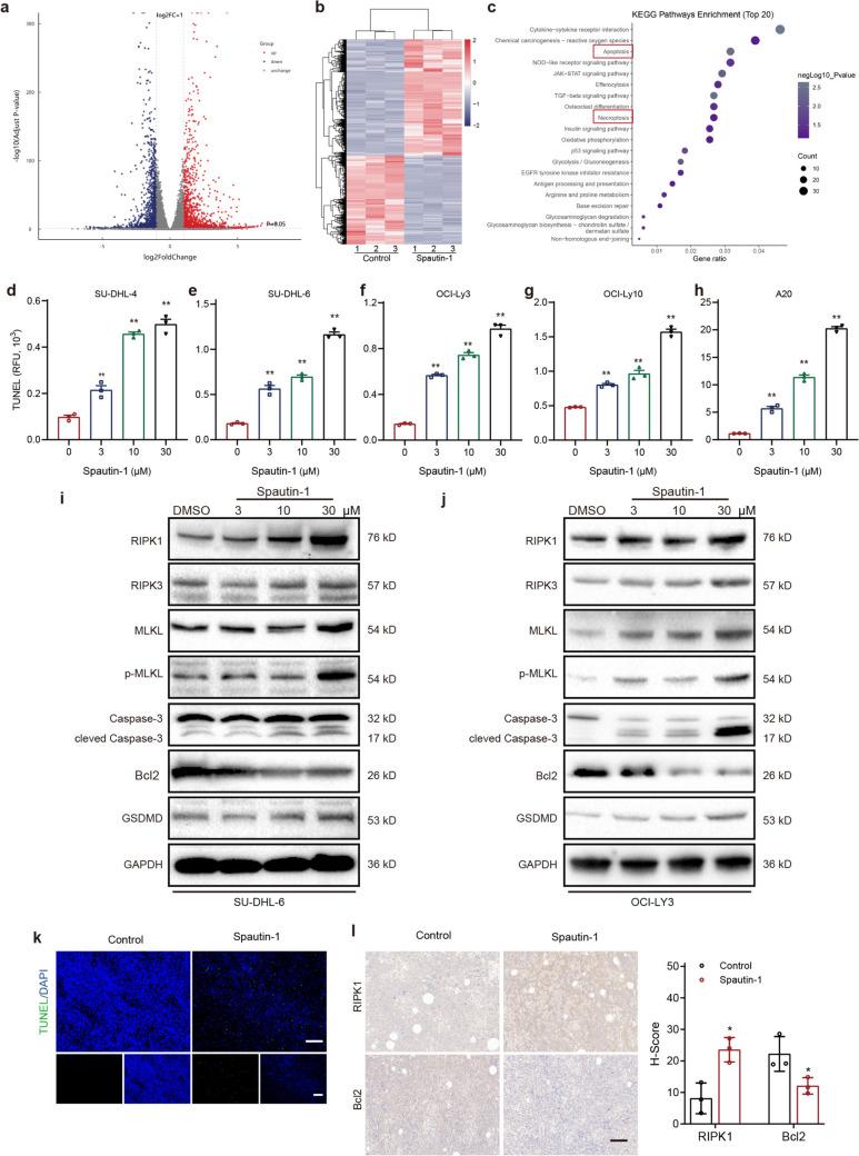 https://cdn.ncbi.nlm.nih.gov/pmc/blobs/1bd2/12378856/5ce4233e026e/262_2025_4150_Fig3_HTML.jpg
