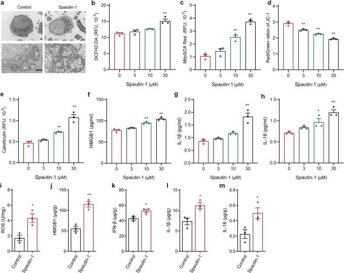 https://cdn.ncbi.nlm.nih.gov/pmc/blobs/1bd2/12378856/b699a5db9aad/262_2025_4150_Fig4_HTML.jpg