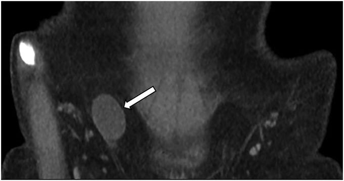 https://cdn.ncbi.nlm.nih.gov/pmc/blobs/1bd8/6902399/94c9e2a225eb/10.1177_2058460119889867-fig10.jpg