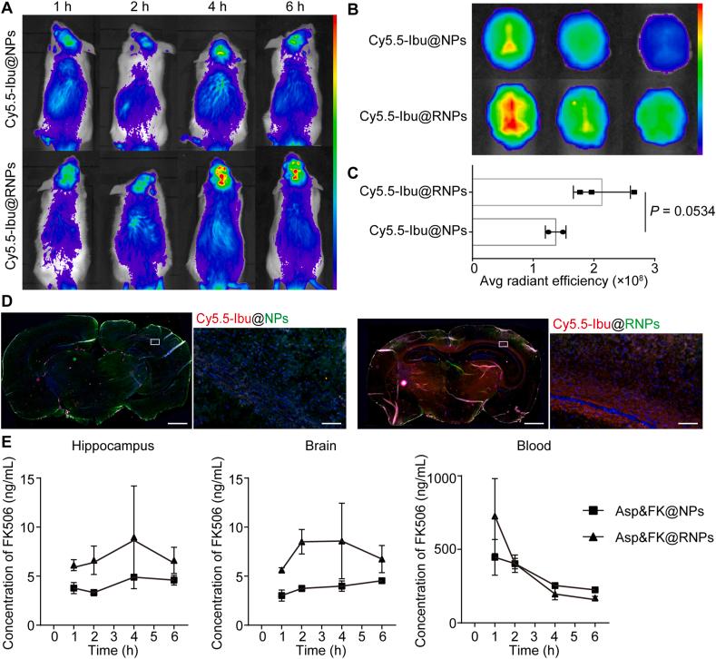 https://cdn.ncbi.nlm.nih.gov/pmc/blobs/1bdd/9279705/8865248204ec/gr4.jpg
