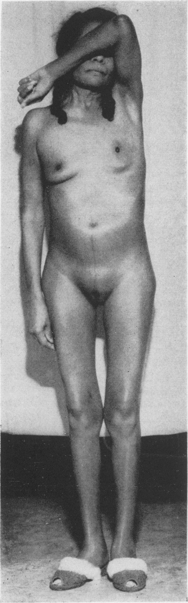 https://cdn.ncbi.nlm.nih.gov/pmc/blobs/1be0/2641321/2b010f9bce2a/jnma00717-0043-a.jpg