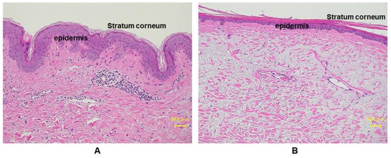 https://cdn.ncbi.nlm.nih.gov/pmc/blobs/1be8/8069861/94fbc6e07627/ijms-22-03974-g003.jpg