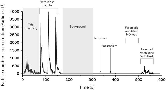 https://cdn.ncbi.nlm.nih.gov/pmc/blobs/1bec/8653000/a1811aee3313/ANAE-77-22-g002.jpg