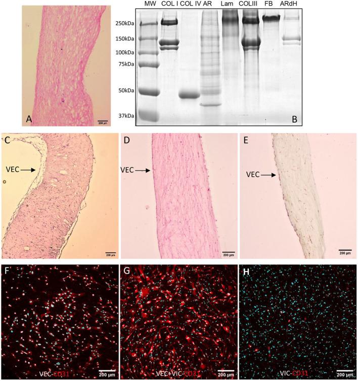https://cdn.ncbi.nlm.nih.gov/pmc/blobs/1bef/8387830/3798f59f5754/fcvm-08-714573-g0001.jpg