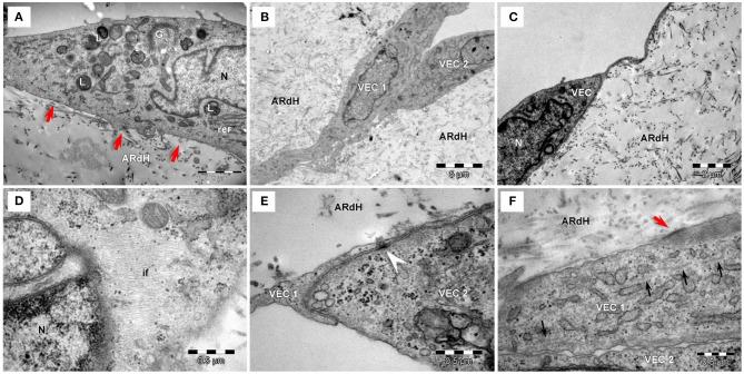 https://cdn.ncbi.nlm.nih.gov/pmc/blobs/1bef/8387830/b58b3b5f4726/fcvm-08-714573-g0004.jpg