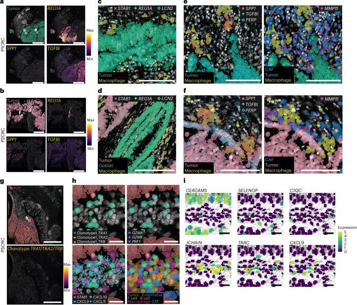 https://cdn.ncbi.nlm.nih.gov/pmc/blobs/1bfc/12165841/92306cf3acd4/41588_2025_2193_Fig7_HTML.jpg