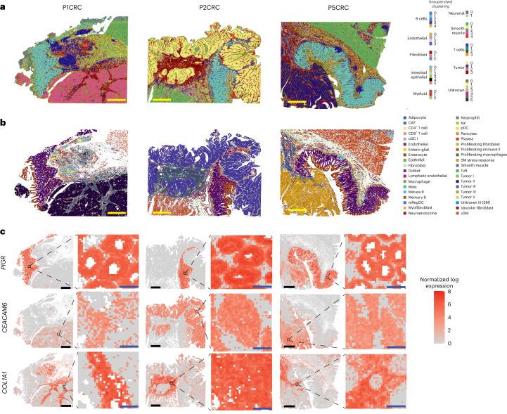 https://cdn.ncbi.nlm.nih.gov/pmc/blobs/1bfc/12165841/a6b909b38c1f/41588_2025_2193_Fig3_HTML.jpg