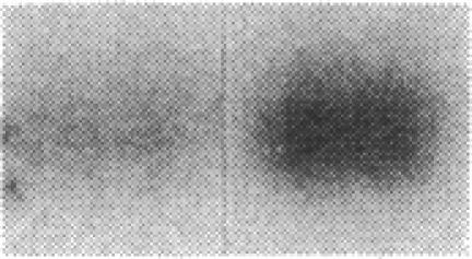 https://cdn.ncbi.nlm.nih.gov/pmc/blobs/1bff/293860/b3c1ab85945b/jcinvest00031-0028-d.jpg