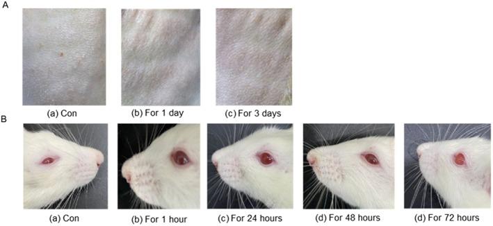 https://cdn.ncbi.nlm.nih.gov/pmc/blobs/1c07/12325102/993df7d16ae7/FSN3-13-e70726-g006.jpg