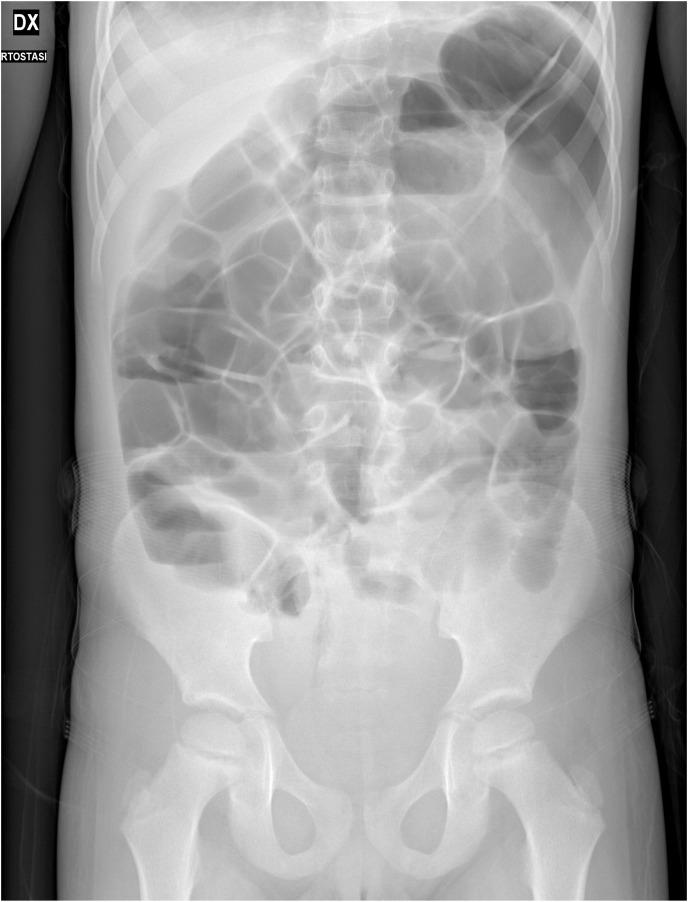 https://cdn.ncbi.nlm.nih.gov/pmc/blobs/1c08/8028611/605887611d5c/gr1a_lrg.jpg