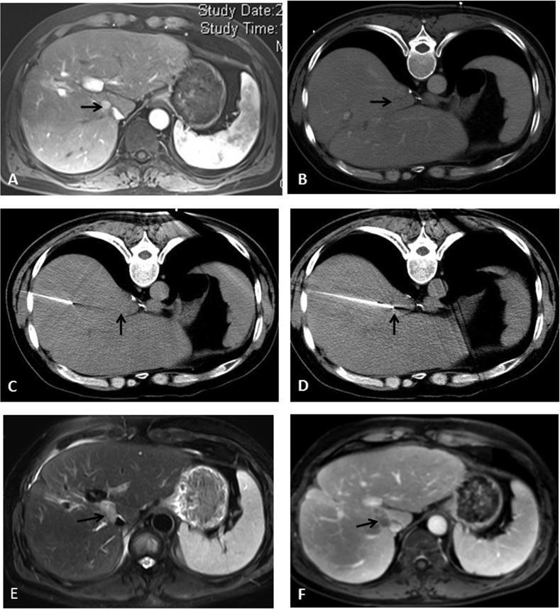 https://cdn.ncbi.nlm.nih.gov/pmc/blobs/1c0a/8562296/863cafb358f8/gr2.jpg