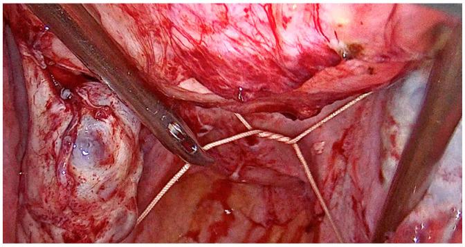 https://cdn.ncbi.nlm.nih.gov/pmc/blobs/1c0c/10672779/7743808bad9b/medicina-59-01979-g001.jpg