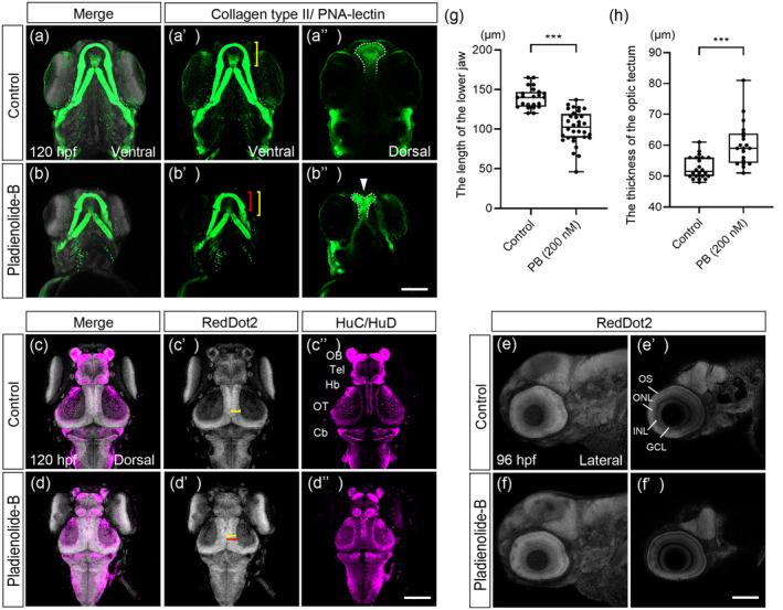 https://cdn.ncbi.nlm.nih.gov/pmc/blobs/1c0c/11579809/210f15745b96/BDR2-116-e2404-g008.jpg