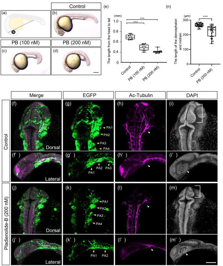 https://cdn.ncbi.nlm.nih.gov/pmc/blobs/1c0c/11579809/59bc77991738/BDR2-116-e2404-g001.jpg