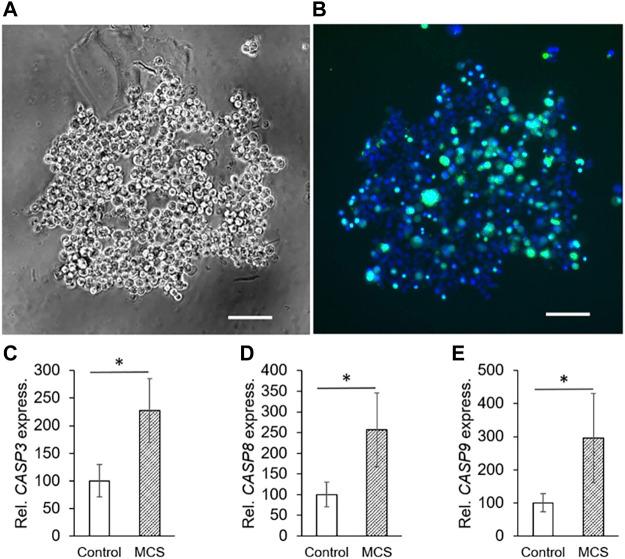 https://cdn.ncbi.nlm.nih.gov/pmc/blobs/1c0d/8893349/f6c81953485d/fcell-10-841017-g002.jpg