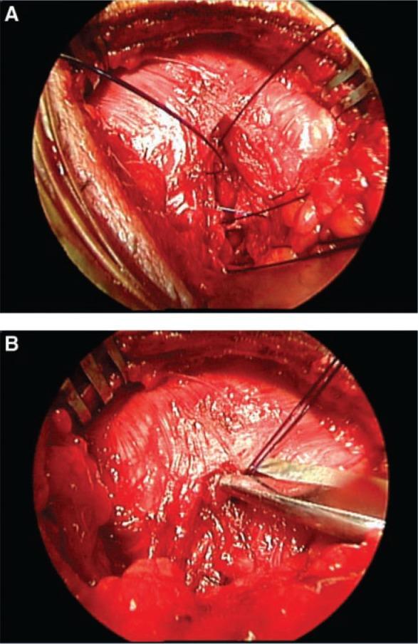 https://cdn.ncbi.nlm.nih.gov/pmc/blobs/1c0e/3445106/b011fa02731a/10.1177_1941738110366203-fig4.jpg