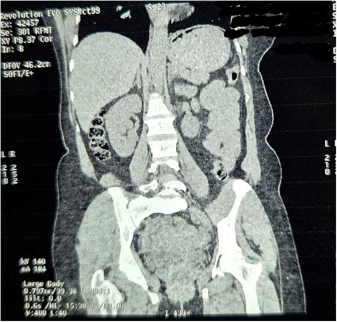 https://cdn.ncbi.nlm.nih.gov/pmc/blobs/1c0f/12205773/2c64e14617e5/gr10.jpg