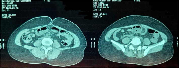 https://cdn.ncbi.nlm.nih.gov/pmc/blobs/1c0f/12205773/ed8e40ce7ca8/gr8.jpg