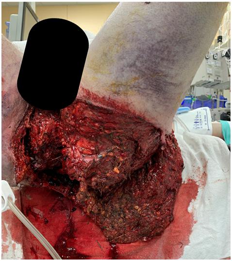 https://cdn.ncbi.nlm.nih.gov/pmc/blobs/1c1f/8889235/cfcf646137c8/gr1.jpg