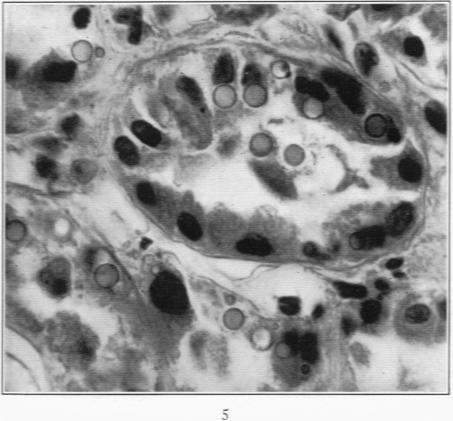 https://cdn.ncbi.nlm.nih.gov/pmc/blobs/1c21/2062873/306286c9bd85/amjpathol00711-0029-a.jpg