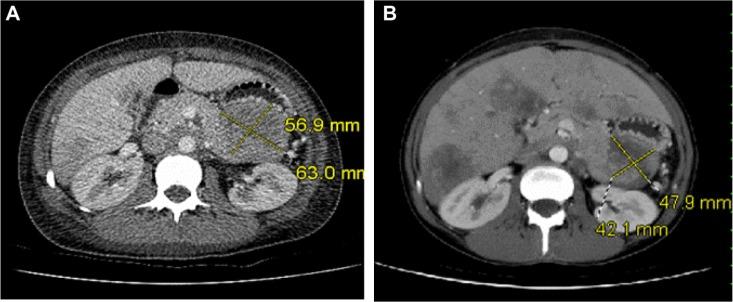 https://cdn.ncbi.nlm.nih.gov/pmc/blobs/1c22/3862645/4a791ac59652/ijgm-7-021Fig2.jpg
