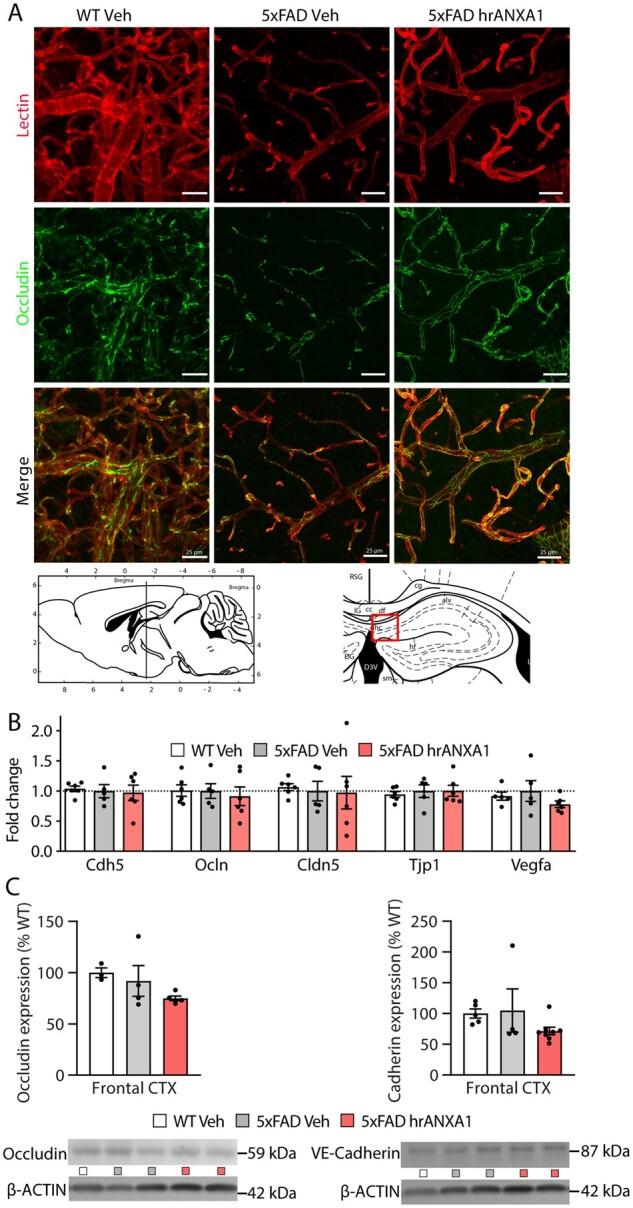 https://cdn.ncbi.nlm.nih.gov/pmc/blobs/1c2a/8262982/667a85a6380d/awab050f3.jpg