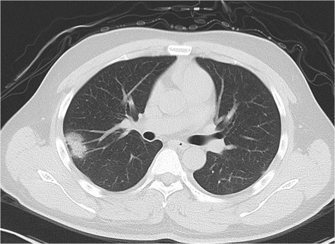 https://cdn.ncbi.nlm.nih.gov/pmc/blobs/1c2d/7431393/00b4e20cfbf6/330_2020_6829_Fig1_HTML.jpg