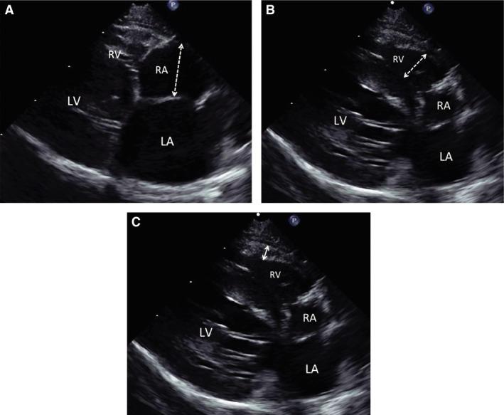 https://cdn.ncbi.nlm.nih.gov/pmc/blobs/1c2f/5435046/8ea1f6ec259c/JVIM-31-668-g001.jpg