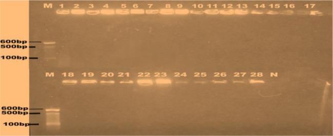 https://cdn.ncbi.nlm.nih.gov/pmc/blobs/1c35/10462460/4dbd1abbaf80/microbiol-09-03-021-g004.jpg