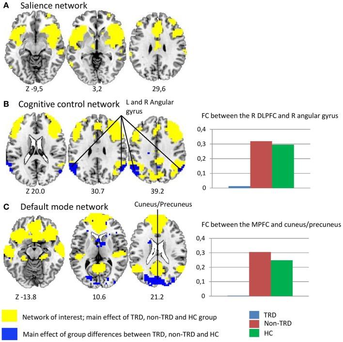 https://cdn.ncbi.nlm.nih.gov/pmc/blobs/1c37/4345766/639810959b8b/fpsyt-06-00028-g001.jpg