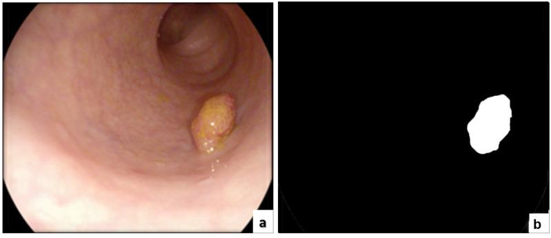 https://cdn.ncbi.nlm.nih.gov/pmc/blobs/1c4e/9739266/20768897657a/sensors-22-09250-g008.jpg