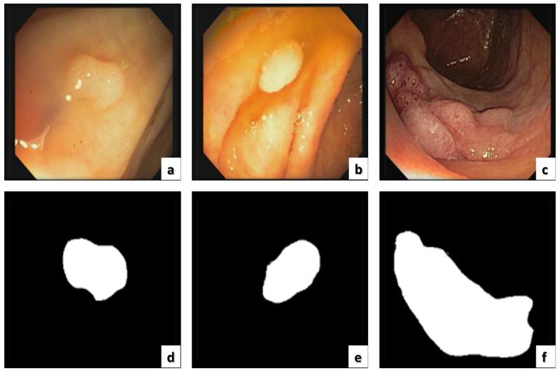 https://cdn.ncbi.nlm.nih.gov/pmc/blobs/1c4e/9739266/3860c29250d2/sensors-22-09250-g009.jpg