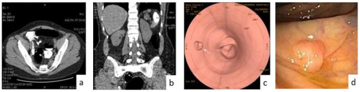 https://cdn.ncbi.nlm.nih.gov/pmc/blobs/1c4e/9739266/d4f0c69a7d9d/sensors-22-09250-g006.jpg